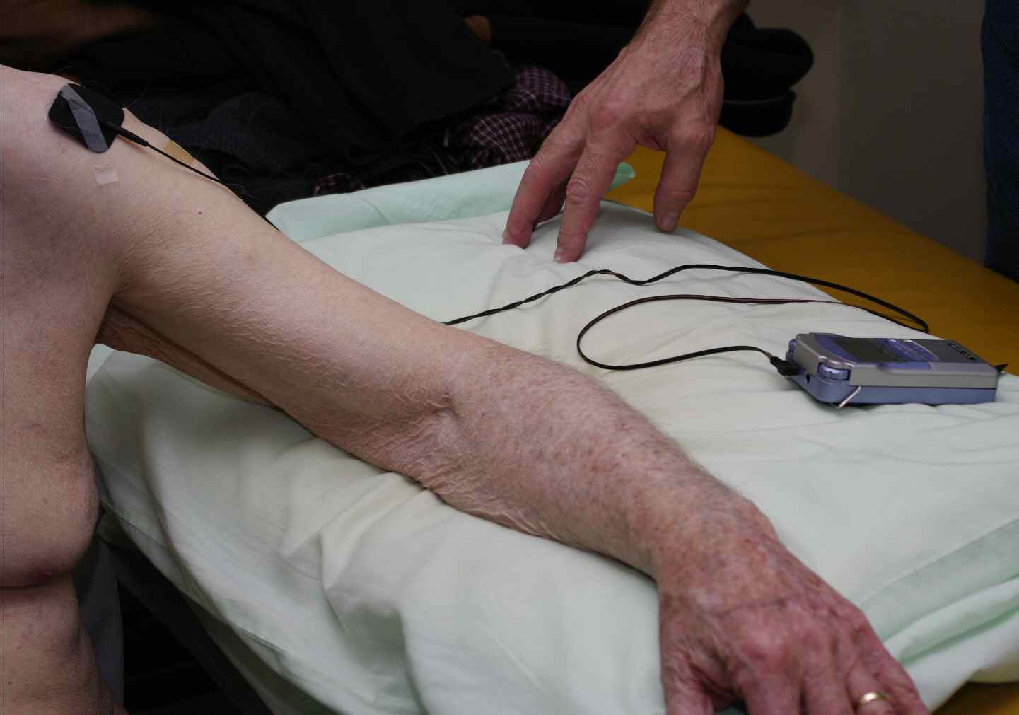 Electrical stimulation applied to shoulder Electrical stimulation applied to shoulder